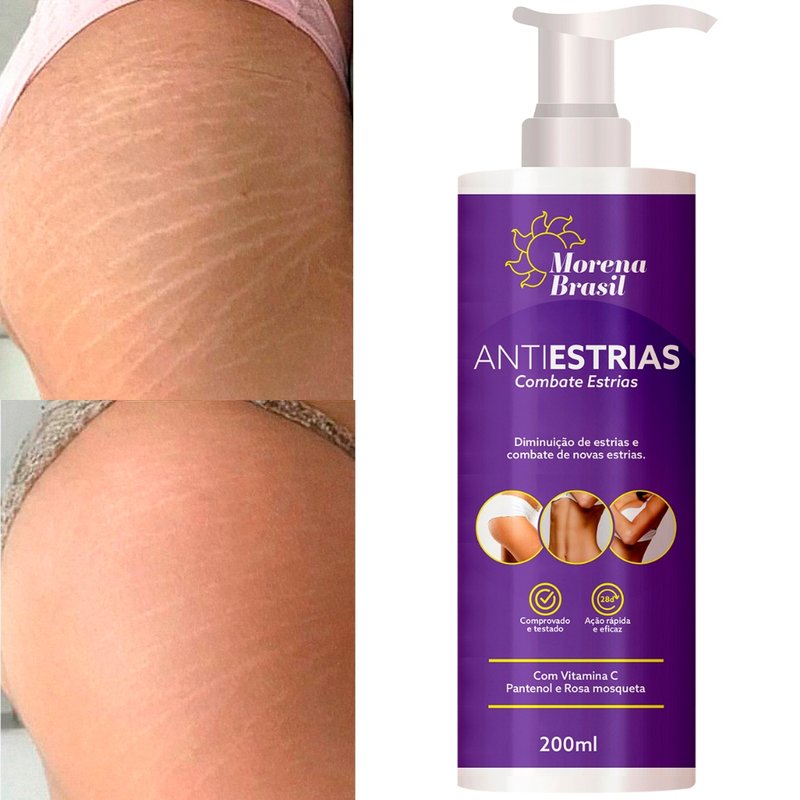 Creme AntiEstrias Removedor Estrias 200g Morena Brasil – Ação Poderosa com Colágeno e Elastina